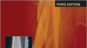 Handbook of Fractures, Third Edition 3rd Edition