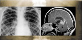 Rapid Review of Radiology (Medical Rapid Review Series) 1st Edition