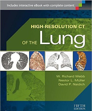 High-Resolution CT of the Lung Fifth Edition