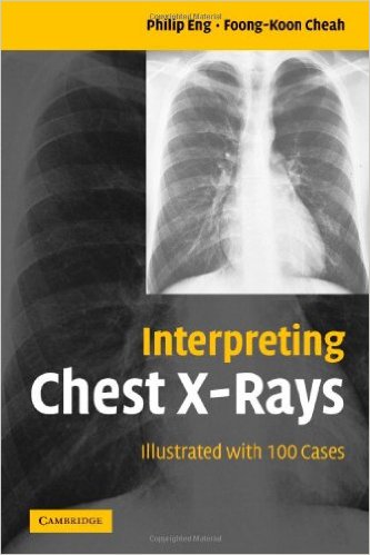 interpreting chest x-rays illustrated with 100 cases free download