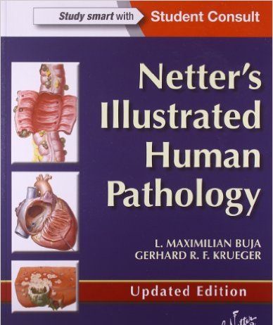Netter’s Illustrated Human Pathology Updated Edition: with Student Consult Access