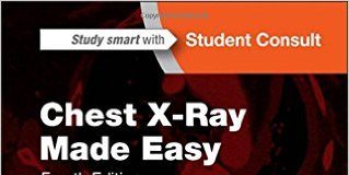Chest X-Ray Made Easy, 4e 4th Edition