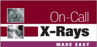 On-Call X-Rays Made Easy, 1e 1st Edition