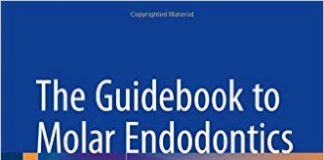 The Guidebook to Molar Endodontics 1st ed. 2017 Edition