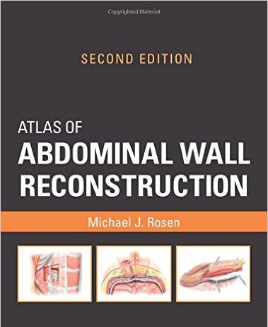 Atlas of Abdominal Wall Reconstruction, 2e 2nd Edition