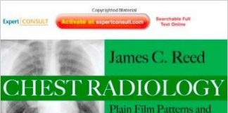 Chest Radiology: Plain Film Patterns and Differential Diagnoses, 6e 6th Edition