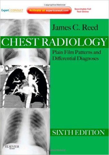 Chest Radiology: Plain Film Patterns and Differential Diagnoses, 6e 6th Edition