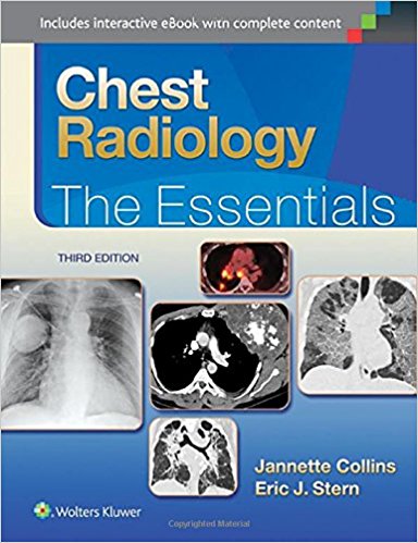 Chest Radiology: The Essentials 3rd Third Edition