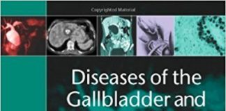 Diseases of the Gallbladder and Bile Ducts: Diagnosis and Treatment 2nd second edition