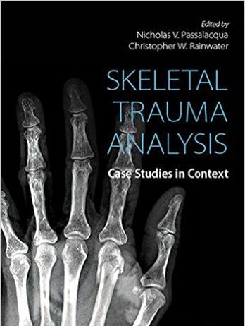Skeletal Trauma Analysis: Case Studies in Context 1st Edition Skeletal-Trauma-Analysis