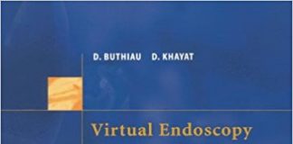 Virtual Endoscopy Virtual Endoscopy