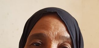 Fekria Ahmed Abd Elatif, CABG Fekria Ahmed Abd Elatif