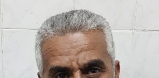 Desouqy Mohamed Mohamed, CABG desouqy