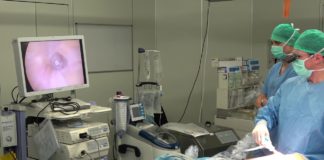 video assisted thoracic surgery