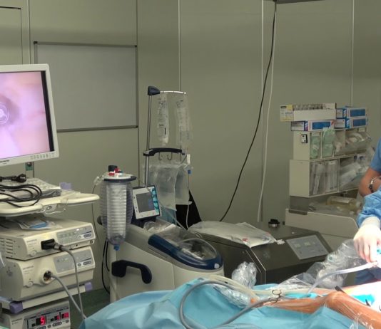 video assisted thoracic surgery