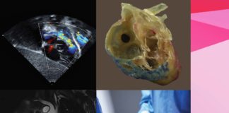 Advanced Congenital Cardiac Morphology