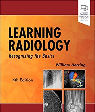 Learning Radiology: Recognizing the Basics 4th Edition Learning Radiology Recognizing the Basics 4th Edition