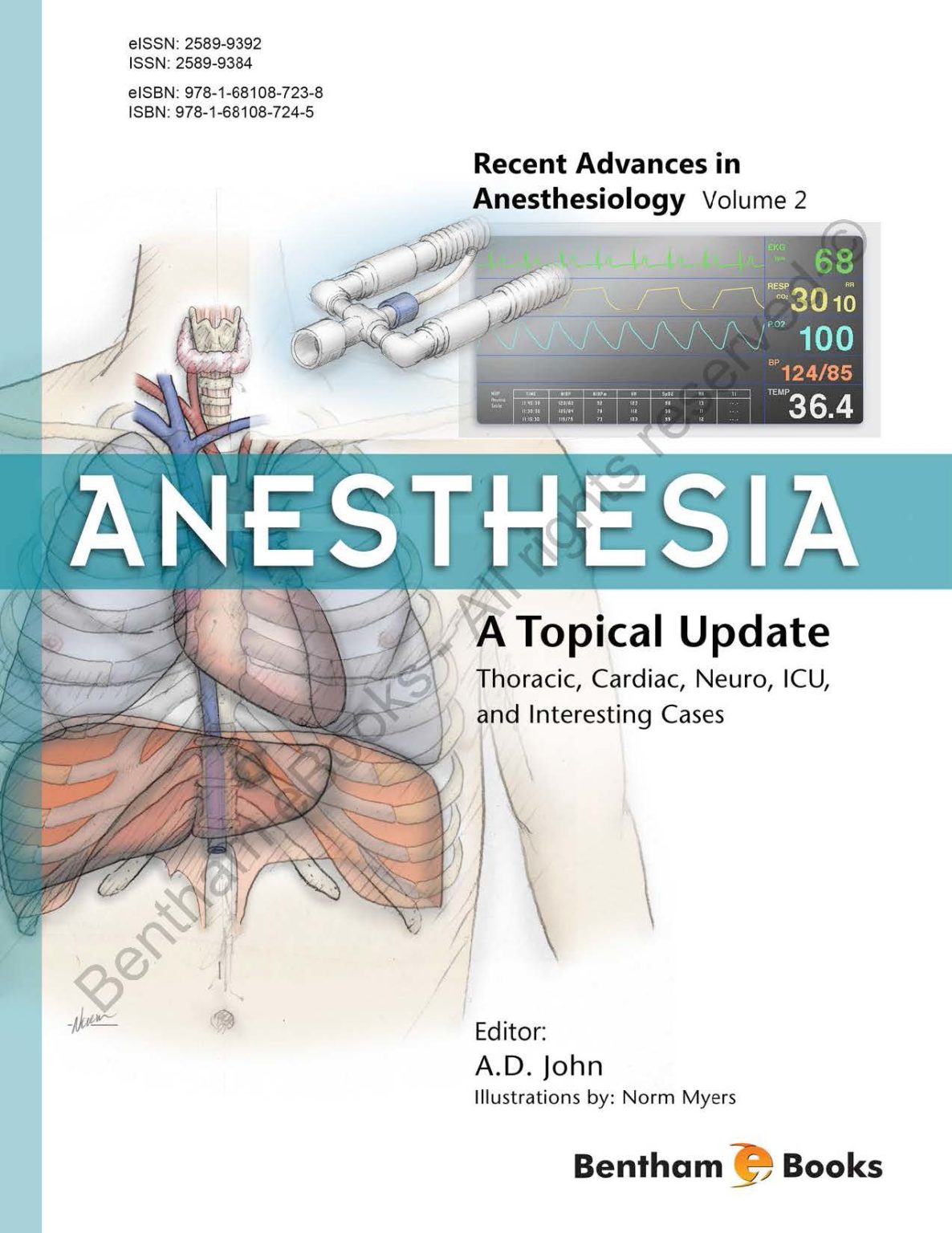 Anesthesia A Topical Update Thoracic, Cardiac, Neuro, ICU, and