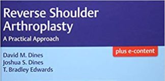 Reverse Shoulder Arthroplasty A Practical Approach 1st Edition