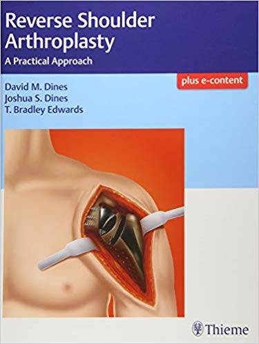 Reverse Shoulder Arthroplasty A Practical Approach 1st Edition