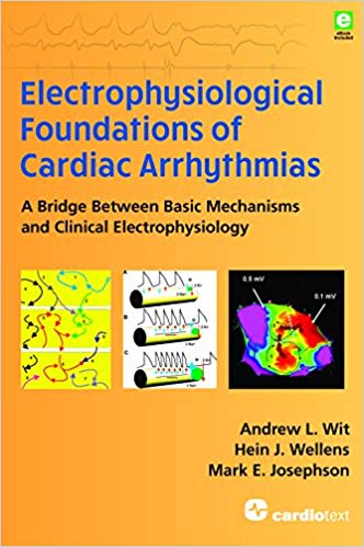 Electrophysiological Foundations of Cardiac Arrhythmias 1st Edition
