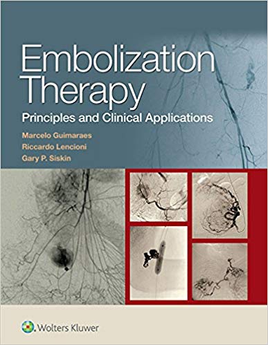 Embolization Therapy Principles and Clinical Applications 1st Edition