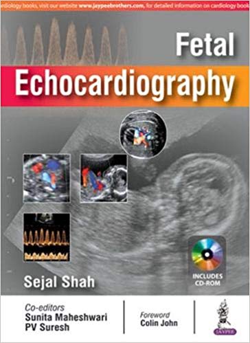 Fetal Echocardiography 1st Edition