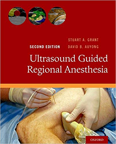 Ultrasound Guided Regional Anesthesia 2nd Edition