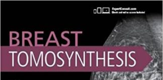 Breast Tomosynthesis 1st Edition Breast Tomosynthesis 1st Edition