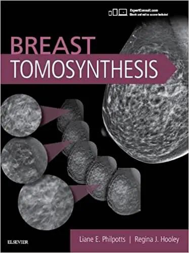 Breast Tomosynthesis 1st Edition