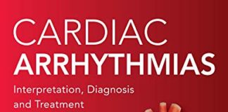 Cardiac Arrhythmias: Interpretation, Diagnosis and Treatment 2nd Edition PDF