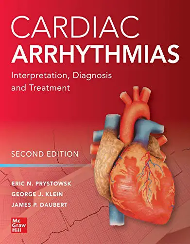Cardiac Arrhythmias: Interpretation, Diagnosis and Treatment 2nd Edition PDF