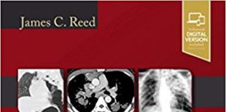 Chest Radiology: Patterns and Differential Diagnoses 7th Edition Chest Radiology: Patterns and Differential Diagnoses 7th Edition