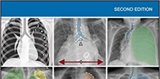 Chest X-Rays for Medical Students 2nd Edition