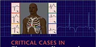 Critical Cases in Electrocardiography