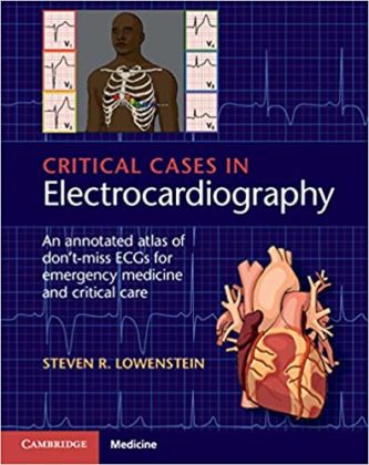 cardiovascular care made incredibly easy pdf
