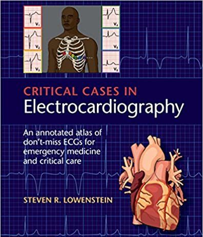 Critical Cases in Electrocardiography: Don’t-Miss ECGs for Emergency and Critical Care 1st Edition Critical Cases in Electrocardiography