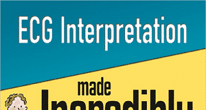 ECG Interpretation Made Incredibly Easy 6th Edition ECG Interpretation Made Incredibly Easy 6th Edition