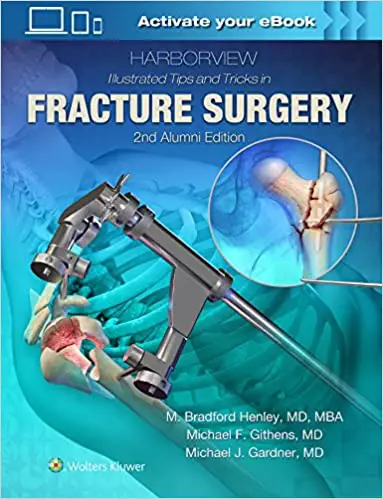 Harborview Illustrated Tips and Tricks in Fracture Surgery 2nd Edition