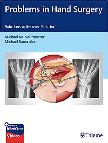 Problems in Hand Surgery Solutions to Recover Function 1st Edition