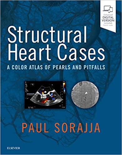Structural Heart Cases: A Color Atlas of Pearls and Pitfalls 1st Edition