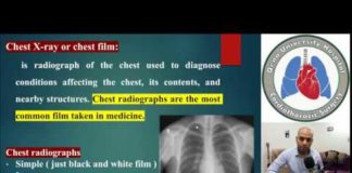 Chest X-Ray Quality: How to Interpret Chest X-Ray