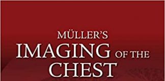 Muller's Imaging of the Chest 2nd Edition