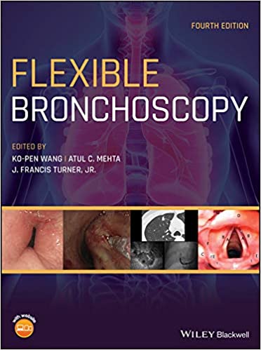 Flexible Bronchoscopy 4th Edition PDF Free Download