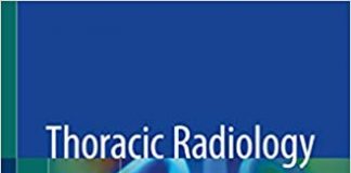Thoracic Radiology: A Guide for Beginners 1st Edition PDF Free Download