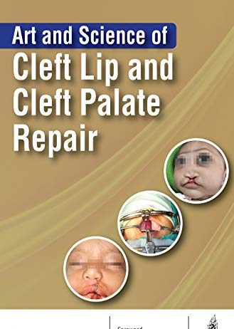 Art and Science of Cleft Lip and Cleft Palate Repair PDF