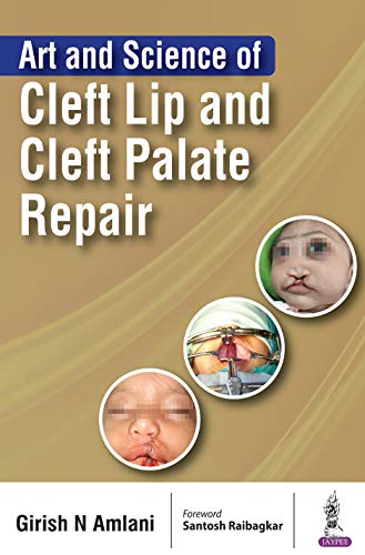 Art and Science of Cleft Lip and Cleft Palate Repair PDF