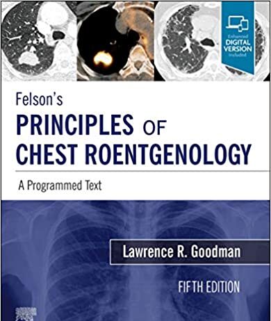 Felson’s Principles of Chest Roentgenology: A Programmed Text 5th Edition PDF Download Felson's Principles of Chest Roentgenology A Programmed Text 5th Edition Free PDF