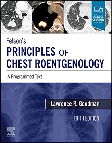 Download Felson's Principles of Chest Roentgenology A Programmed Text 5th Edition Free PDF