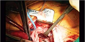 Fundamentals of Congenital Minimally Invasive Cardiac Surgery 1st Edition PDF